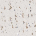 Immunohistochemical staining of human cerebral cortex shows moderate cytoplasmic positivity in neurons.