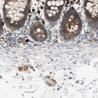 Immunohistochemical staining of human rectum shows moderate cytoplasmic positivity in peripheral ganglia, as well as glandular and lymphoid cells.