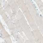Immunohistochemical staining of human skeletal muscle shows no positivity in striated muscle fibers as expected.