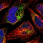 Immunofluorescent staining of human cell line U-2 OS shows localization to endoplasmic reticulum.