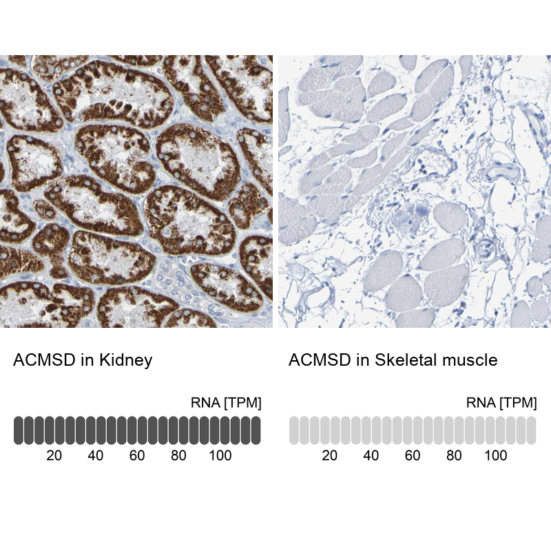 Anti-ACMSD Antibody