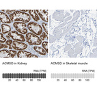 Anti-ACMSD Antibody