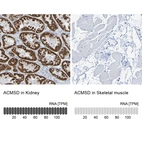 Anti-ACMSD Antibody