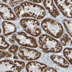 Immunohistochemical staining of human kidney shows strong cytoplasmic positivity in cells in tubules.