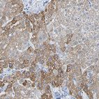 Immunohistochemical staining of human liver shows moderate cytoplasmic positivity in hepatocytes.