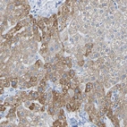 Immunohistochemical staining of human liver shows moderate cytoplasmic positivity in hepatocytes.