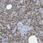 Immunohistochemical staining of human pancreas shows strong cytoplasmic positivity in exocrine glandular cells.