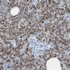 Immunohistochemical staining of human pancreas shows strong cytoplasmic positivity in exocrine glandular cells.