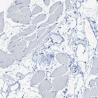 Immunohistochemical staining of human skeletal muscle shows negative cytoplasmic positivity in myocytes as expected.