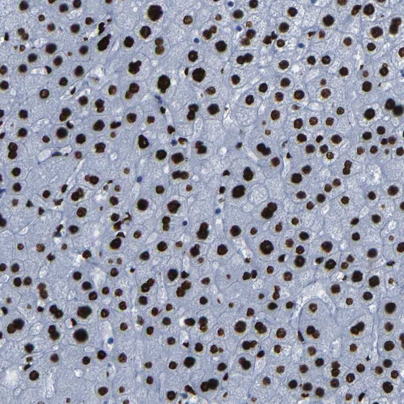 Anti-NPIPB15 Antibody