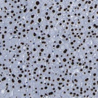 Anti-NPIPB15 Antibody