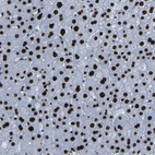 Anti-NPIPB15 Antibody
