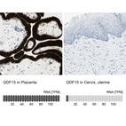 Anti-GDF15 Antibody