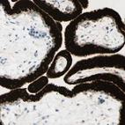 Immunohistochemical staining of human placenta shows very strong cytoplasmic positivity in trophoblastic cells.