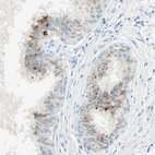Immunohistochemical staining of human prostate shows moderate cytoplasmic positivity in a small subset of glandular cells.