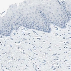 Immunohistochemical staining of human cervix shows no positivity in squamous epithelial cells as expected.