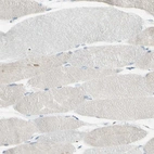Immunohistochemical staining of human skeletal muscle shows no positivity in myocytes as expected.