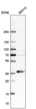 Western blot analysis in human cell line BEWO.