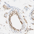 Anti-FGF4 Antibody