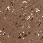 Immunohistochemical staining of human cerebral cortex shows moderate to strong cytoplasmic positivity in neurons.