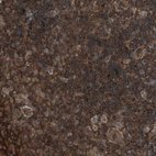 Immunohistochemical staining of human lymphoid tissues shows strong cytoplasmic positivity in non-germinal center cells.