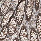 Immunohistochemical staining of human colon shows moderate cytoplasmic positivity in glandular cells.