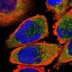 Immunofluorescent staining of human cell line A-431 shows localization to cytosol.
