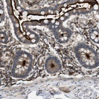 Anti-KSR1 Antibody
