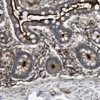 Anti-KSR1 Antibody