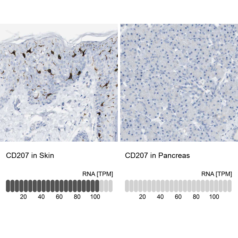 Anti-CD207 Antibody