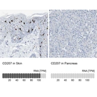 Anti-CD207 Antibody