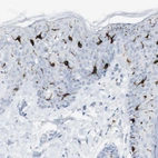 Immunohistochemical staining of human skin shows strong cytoplasmic positivity in Langerhans cells.