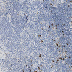 Immunohistochemical staining of human tonsil shows strong cytoplasmic positivity in a subset of non-germinal center cells.