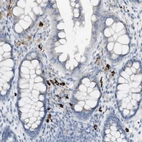 Immunohistochemical staining of human colon shows strong cytoplasmic positivity in a subset of lymphoid cells.