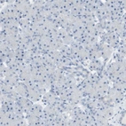 Immunohistochemical staining of human pancreas shows no positivity in exocrine glandular cells as expected.