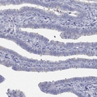 Immunohistochemical staining of human fallopian tube shows weak to moderate positivity in apical membrane and cilia in glandular cells.