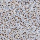 Anti-GALNT2 Antibody