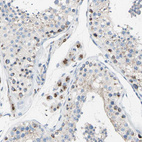 Immunohistochemical staining of human testis shows strong cytoplasm granular positivity in Leydig cells.