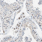 Immunohistochemical staining of human testis shows strong cytoplasm granular positivity in Leydig cells.
