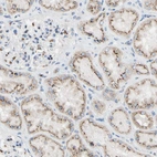 Immunohistochemical staining of human kidney shows strong cytoplasm granular positivity in cells in tubules.