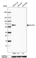 Western blot analysis in HeLa cells transfected with control siRNA, target specific siRNA probe #1 and #2, using Anti-GALNT2 antibody. Remaining relative intensity is presented. Loading control: Anti-GAPDH.