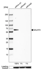 Western blot analysis in HeLa cells transfected with control siRNA, target specific siRNA probe #1 and #2, using Anti-GALNT2 antibody. Remaining relative intensity is presented. Loading control: Anti-GAPDH.