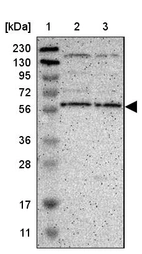 Lane 1: Marker [kDa] 230, 130, 95, 72, 56, 36, 28, 17, 11_br/_Lane 2: Human cell line RT-4_br/_Lane 3: Human cell line U-251MG sp