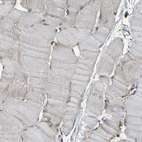 Immunohistochemical staining of human skeletal muscle shows low expression as expected.