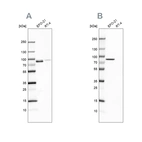 Western blot analysis using Anti-MSN antibody HPA011227 (A) shows similar pattern to independent antibody HPA011135 (B).