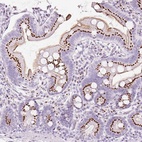 Anti-SDF4 Antibody