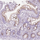 Immunohistochemical staining of human small intestine shows high expression.