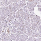 Immunohistochemical staining of human pancreas shows low expression as expected.