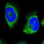 Immunofluorescent staining of human cell line U-251 MG shows localization to endoplasmic reticulum.