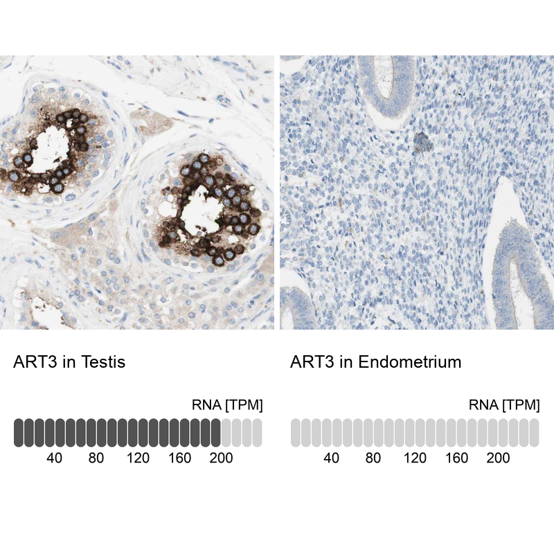 Anti-ART3 Antibody